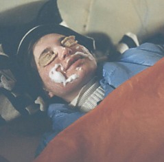 Одна из жертв горного ультрафиолета.